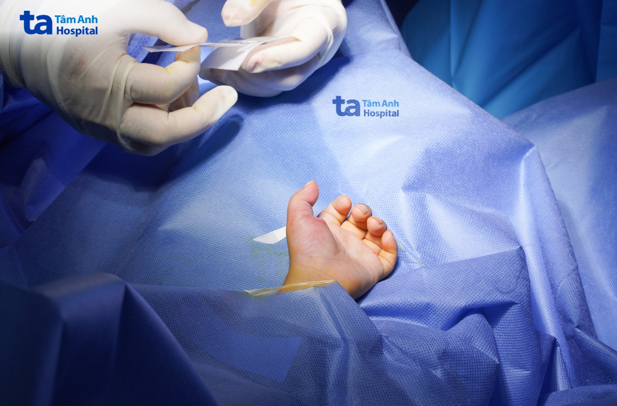 bàn tay trái của mẫn sau phẫu thuật