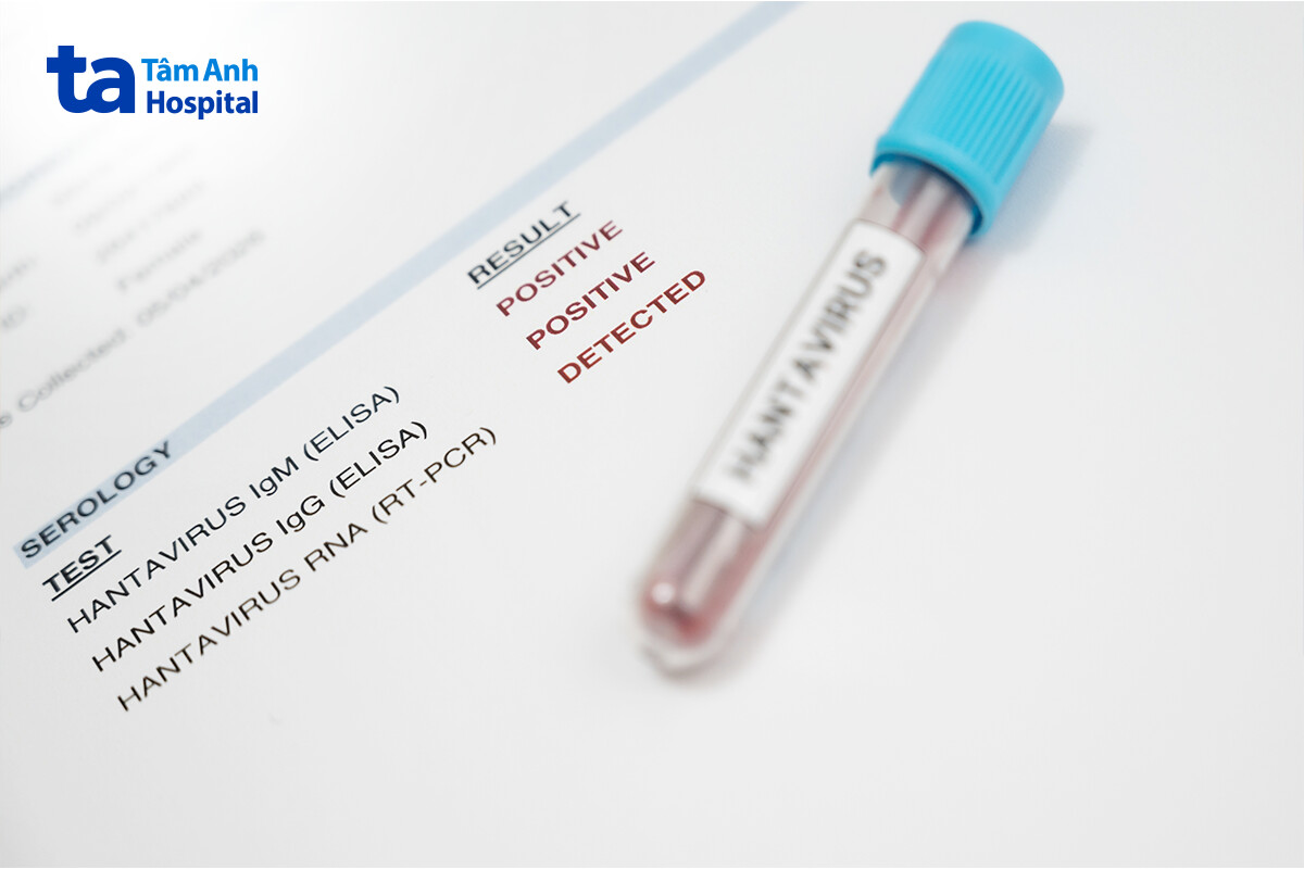 các loại test hanta virus