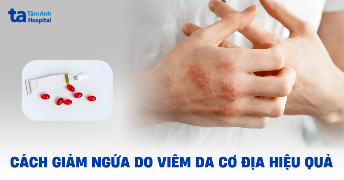 Tham khảo cách giảm ngứa khi bị viêm da cơ địa