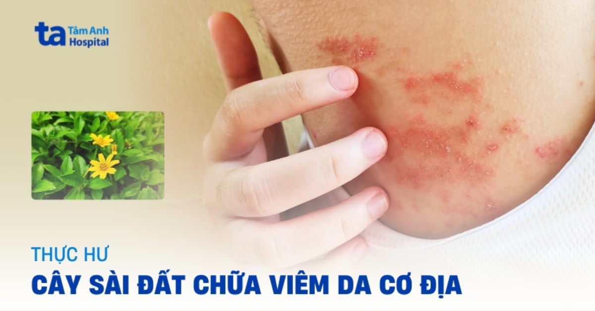 Cẩn trọng khi dùng cây sài đất chữa viêm da cơ địa