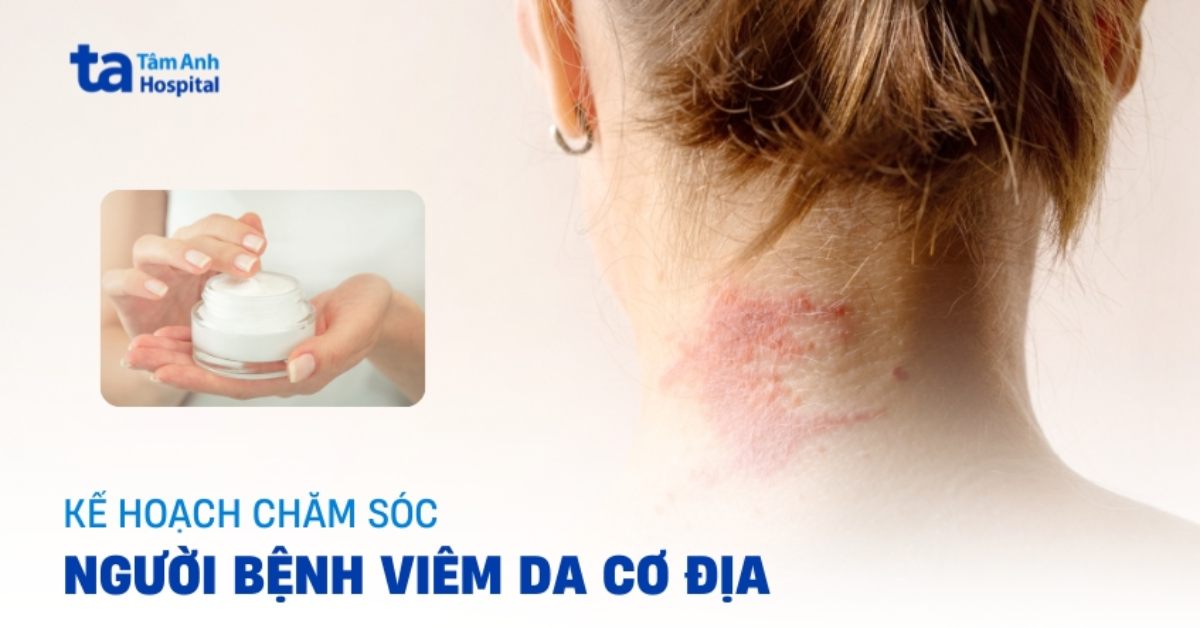 Nguyên tắc khi chăm sóc bệnh nhân viêm da cơ địa