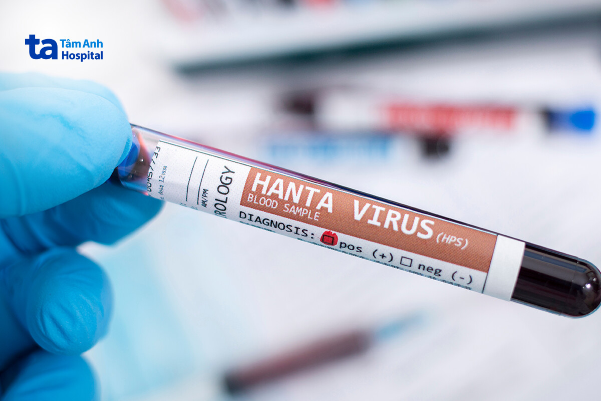 chẩn đoán hanta virus