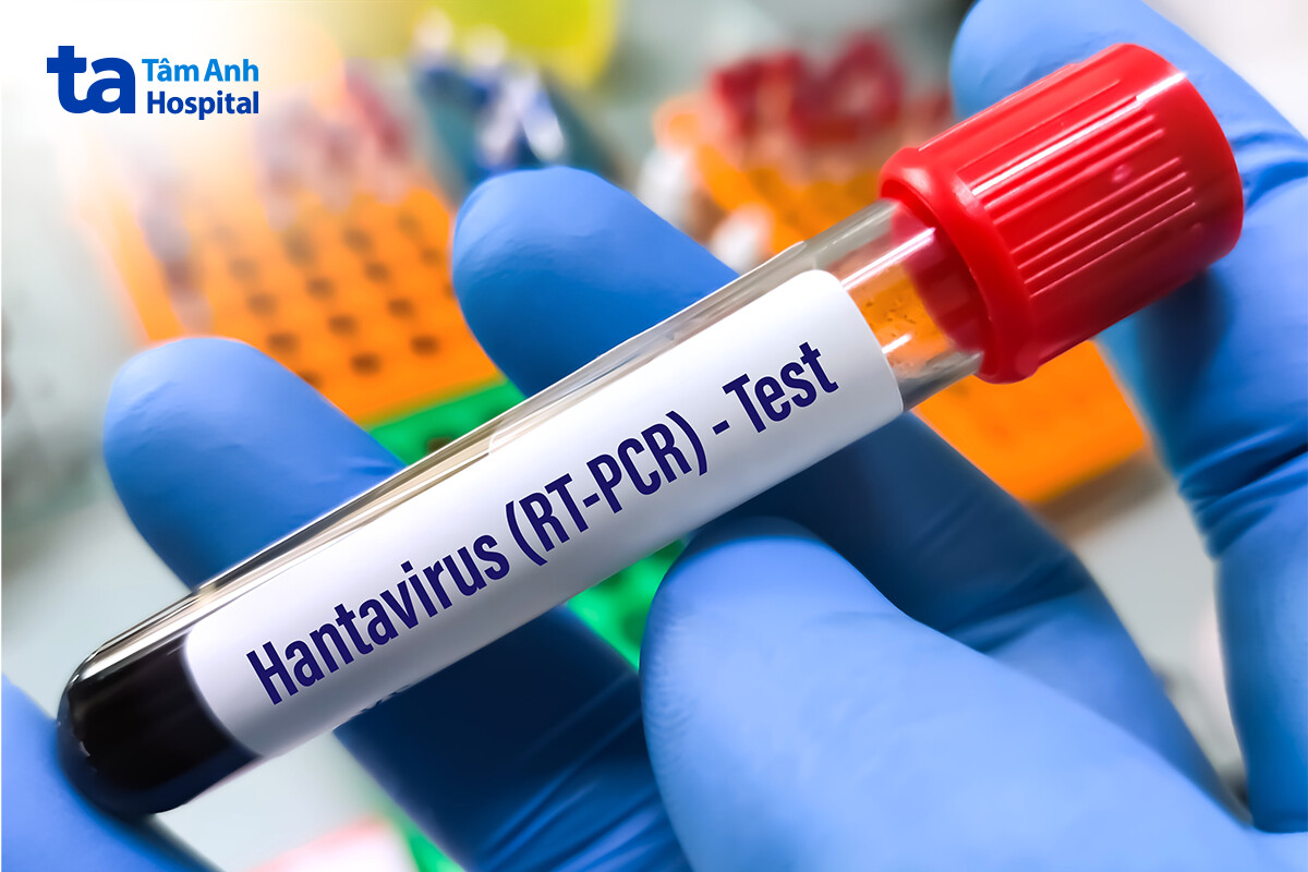 chẩn đoán virus hanta