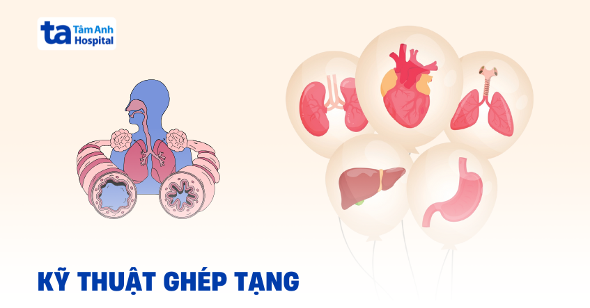 Ghép tạng là gì? Quy trình, lợi ích và điều kiện bắt buộc