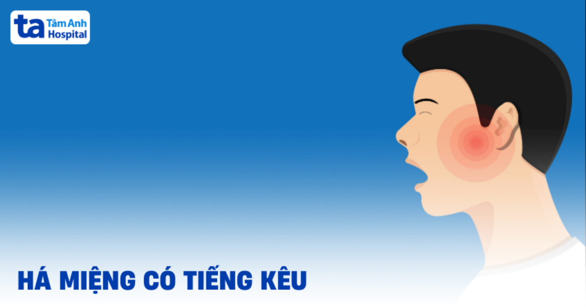 Há Miệng Có Tiếng Kêu