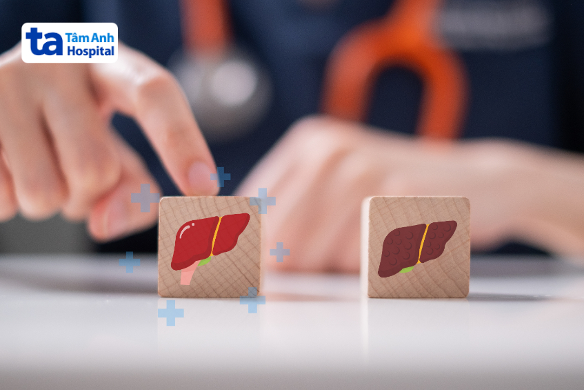 hiến gan vẫn có thể sống khỏe mạnh