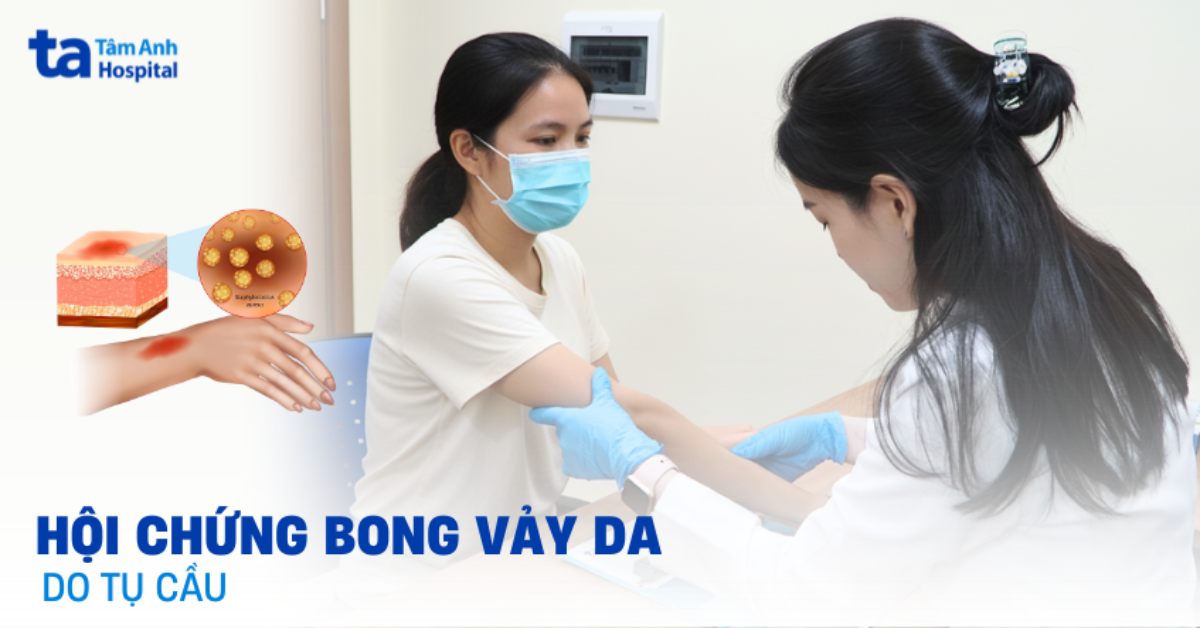 Hội chứng bong vảy da do tụ cầu (4S): Hiểu về căn bệnh lạ