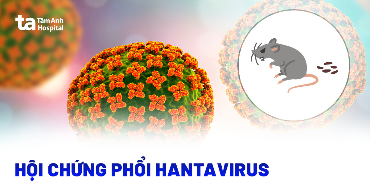 Hội chứng phổi do virus Hanta​: Dấu hiệu và hướng điều trị