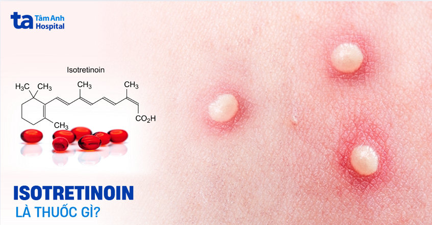 Isotretinoin là gì? Tác dụng, liều dùng và chống chỉ định