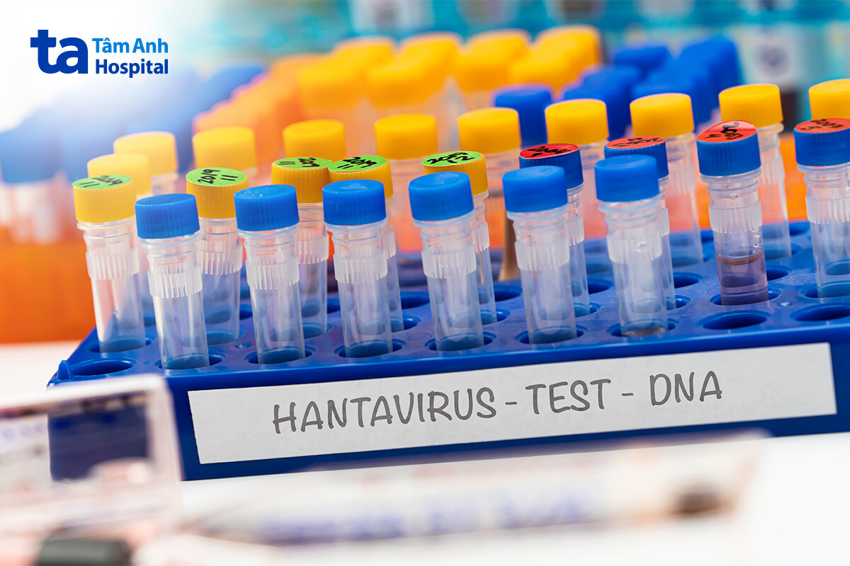 khi nào nên test nhanh hantavirus
