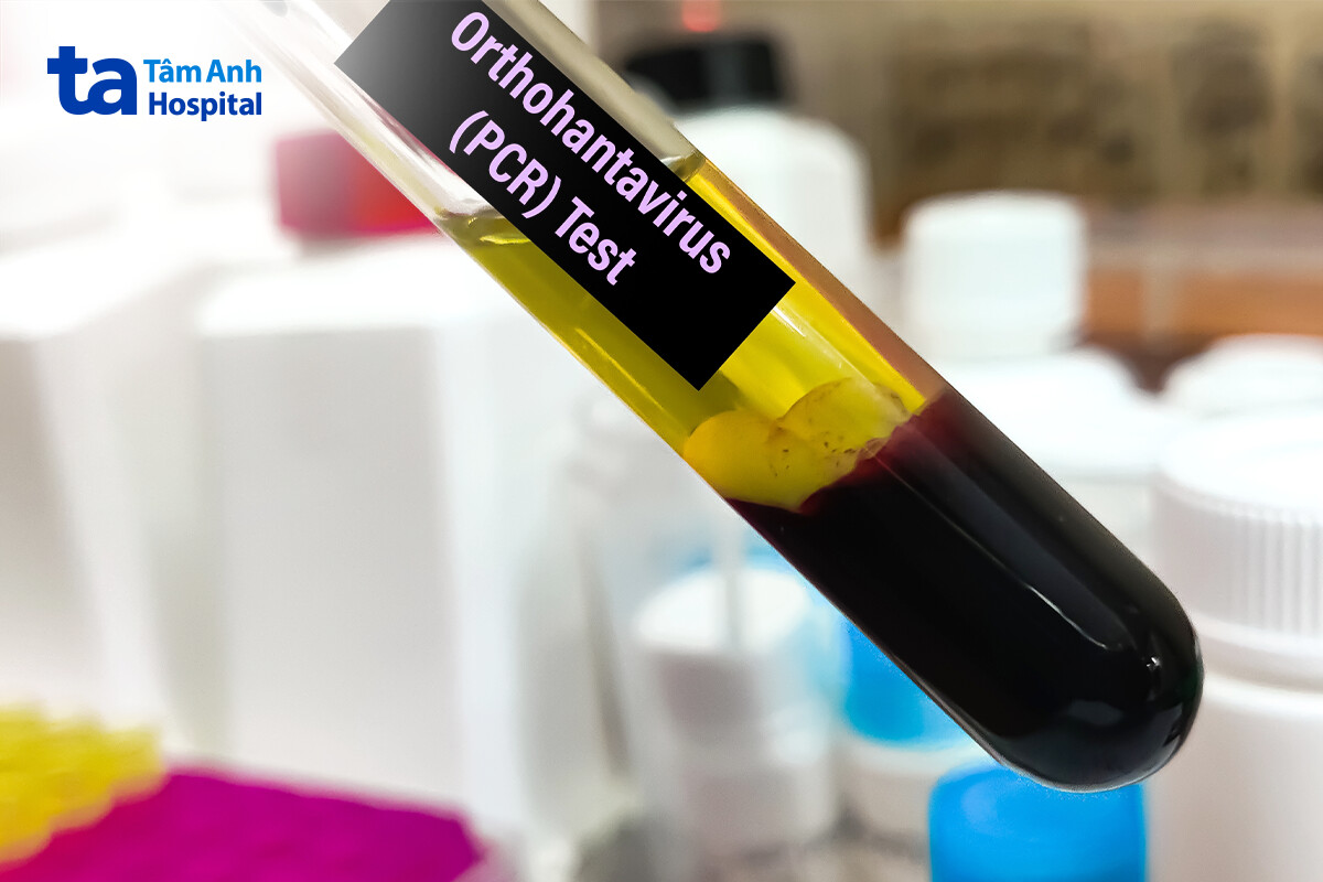 lưu ý khi xét nghiệm virus hanta