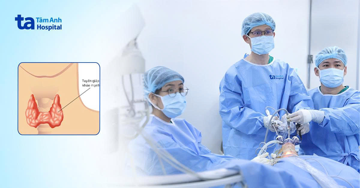 Mổ ung thư tuyến giáp không sẹo