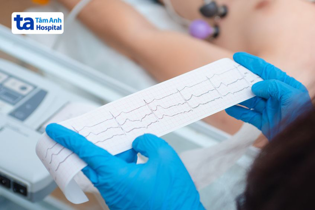 Ngoài siêu âm bác sĩ có thể sử dụng phương pháp đo điện tim (ECG) để chẩn đoán suy tim