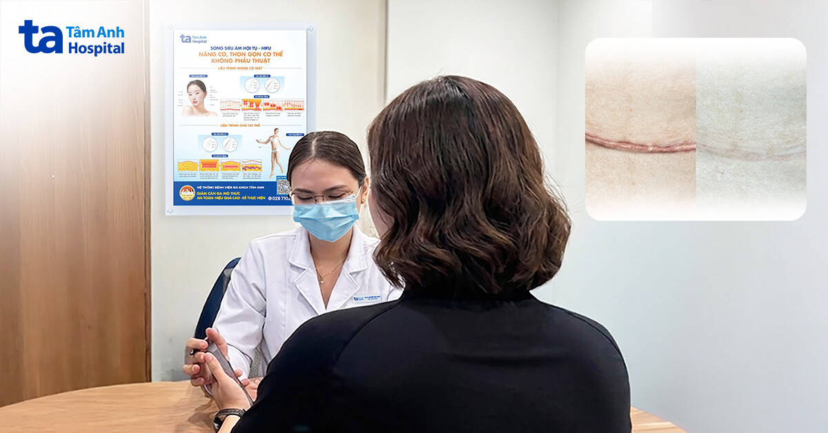 Ngứa dai dẳng do sẹo lồi sau sinh