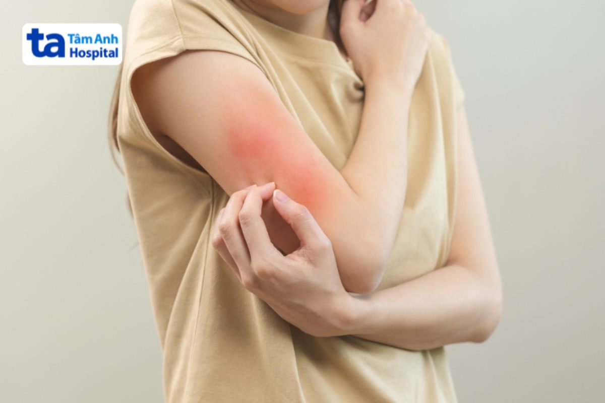 người bệnh bị ngứa