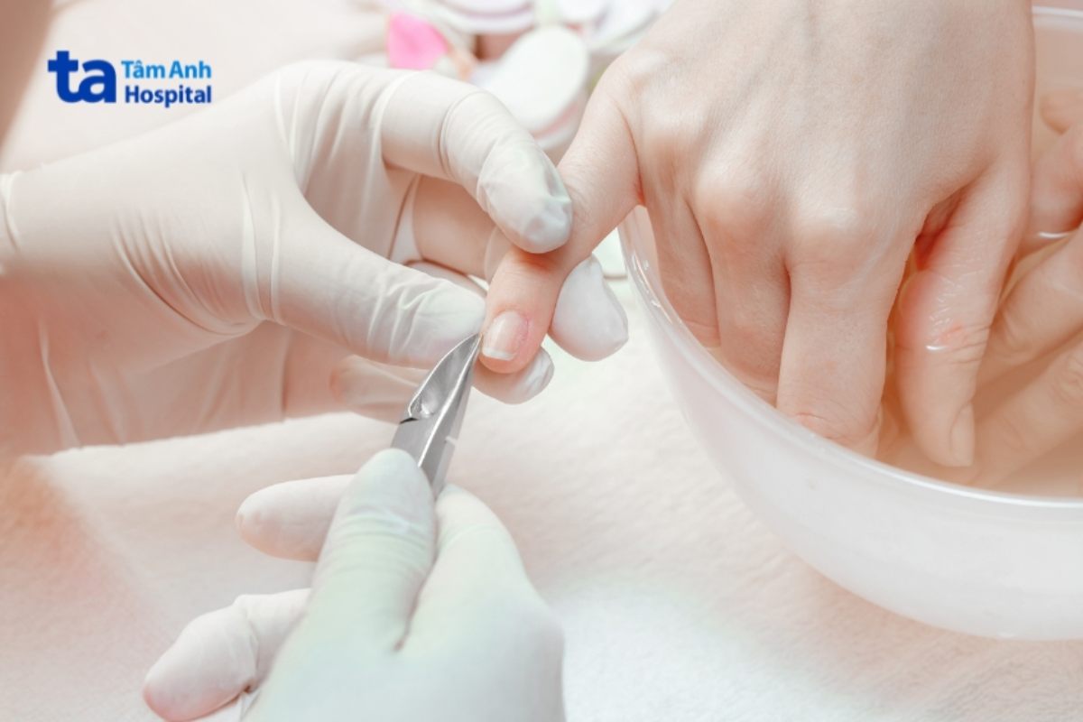 người bệnh nên cắt móng tay