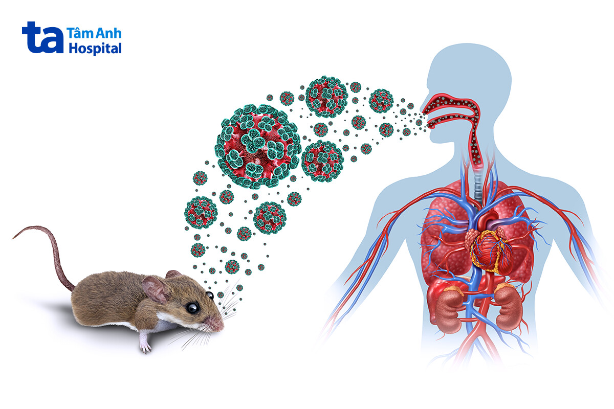Hội chứng phổi do virus Hanta (HPS): Dấu hiệu và hướng điều trị 12 nguyên nhân hantavirus gây ra hội chứng phổi