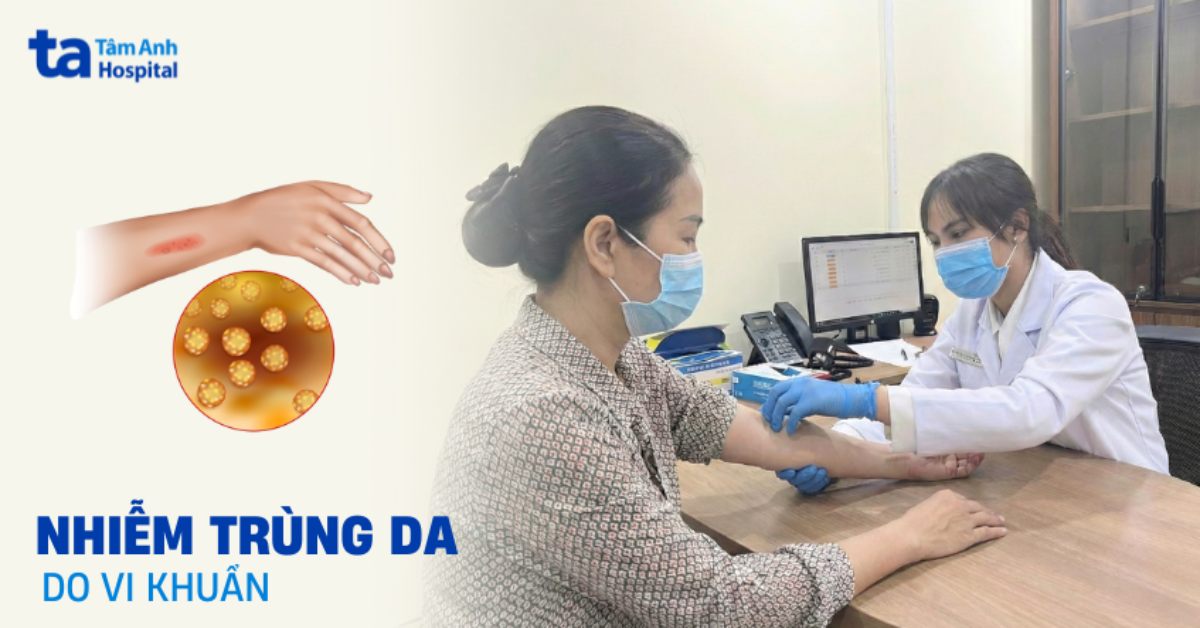 Nhiễm trùng da do vi khuẩn: Tìm hiểu thêm chi tiết