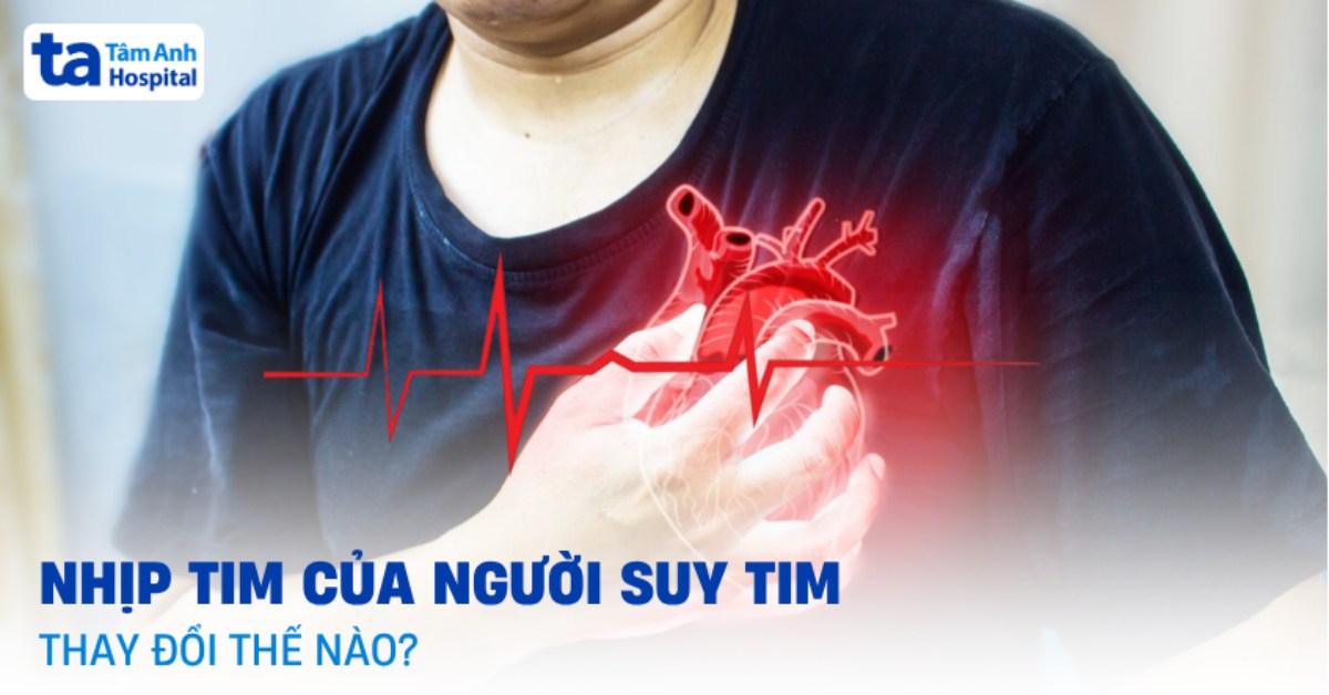 Nhịp tim của người suy tim bao nhiêu thì cần kiểm soát?