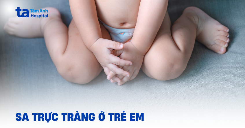 Sa trực tràng trẻ em phải xử trí như thế nào cho đúng?