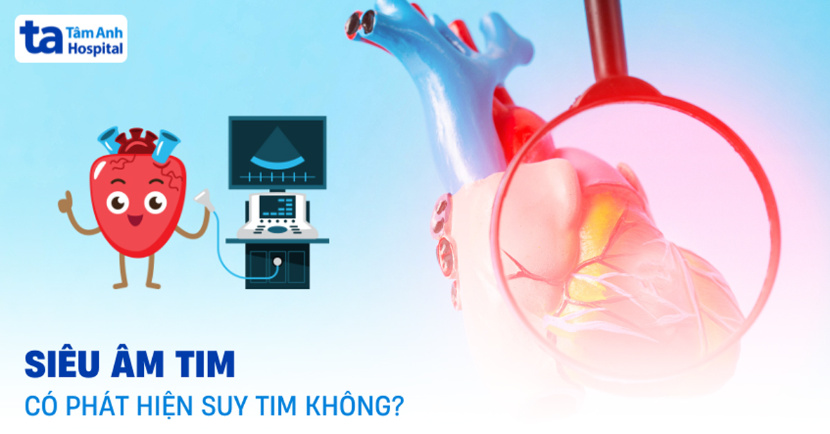 Vai trò của siêu âm tim có phát hiện suy tim không?