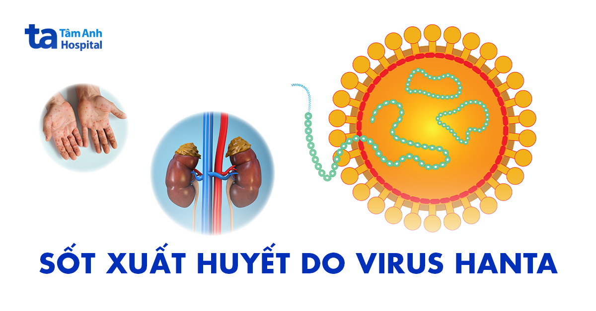 Sốt xuất huyết do virus Hanta: Nguy cơ phải đối mặt​