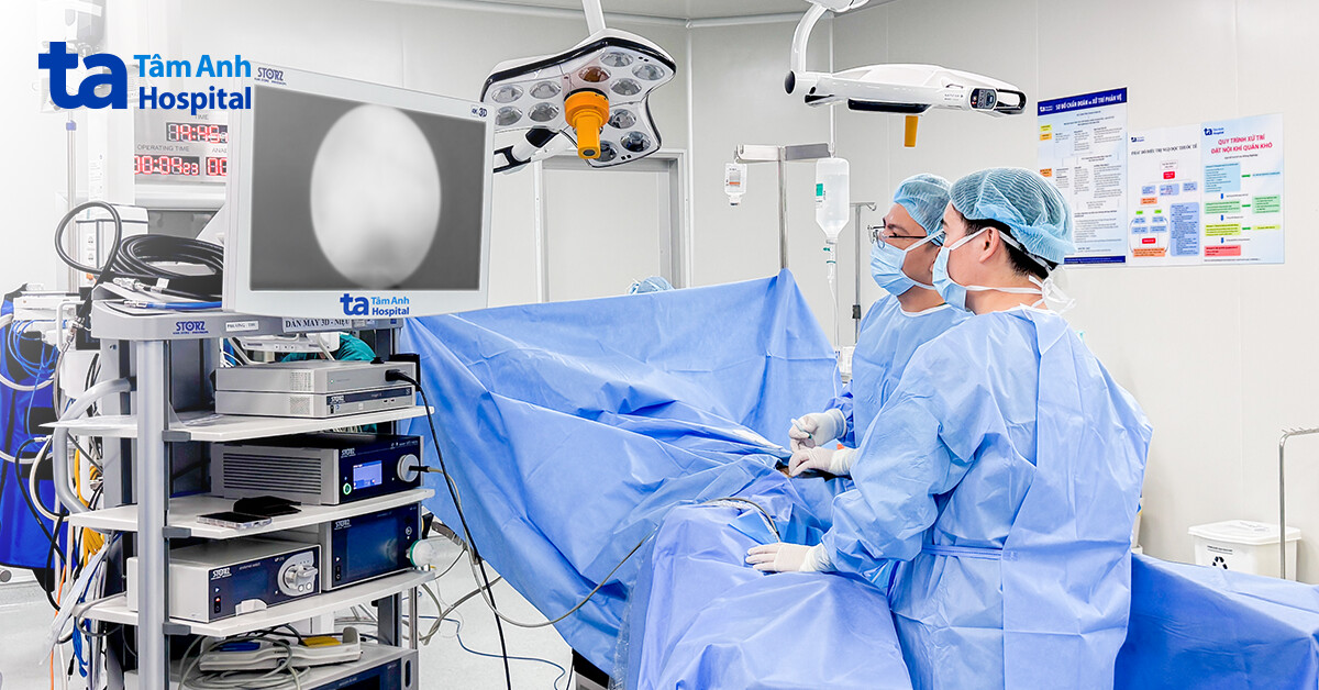 Stent niệu quản “đi lạc” lên thận
