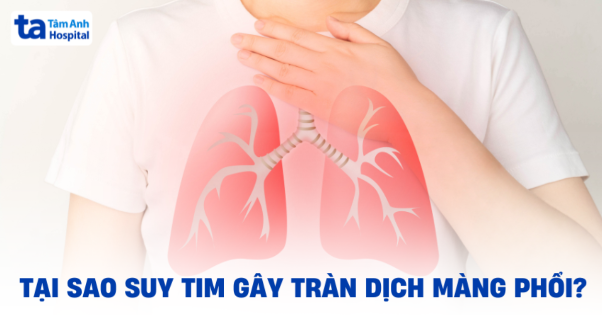suy tim gây tràn dịch màng phổi