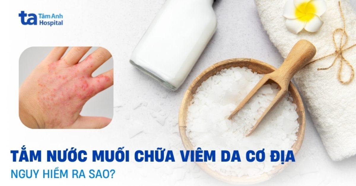 Tắm nước muối chữa viêm da cơ địa: Hiểu đúng để tránh biến chứng