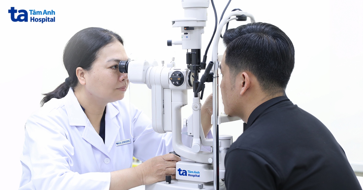 Tăng nhãn áp vì nhỏ corticoid kéo dài