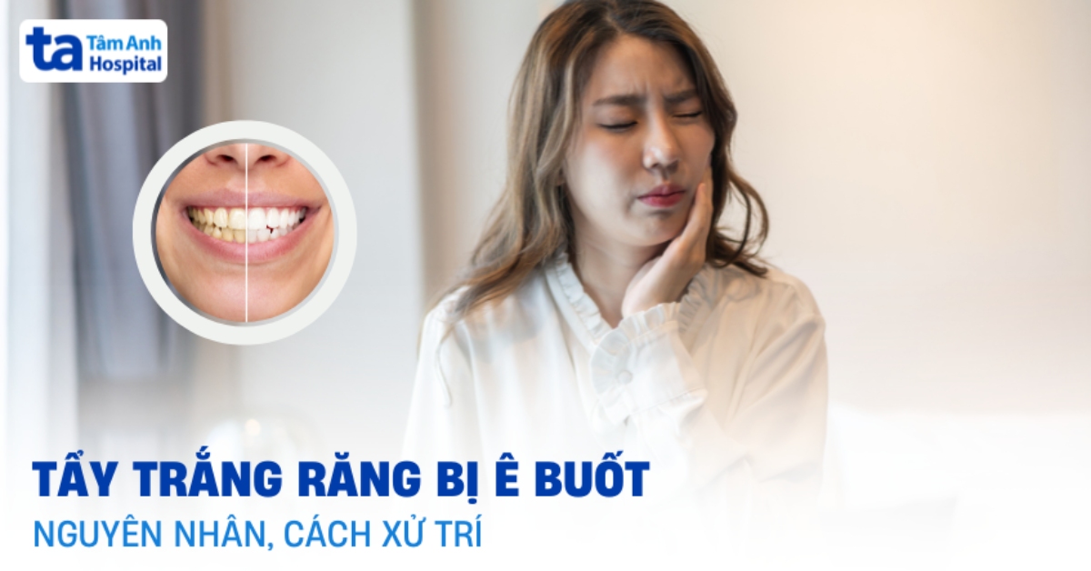 Tẩy trắng răng bị ê buốt do đâu, bao lâu thì hết và xử lý ra sao?