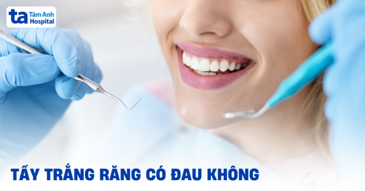 Tẩy Trắng Răng Có Đau Không 