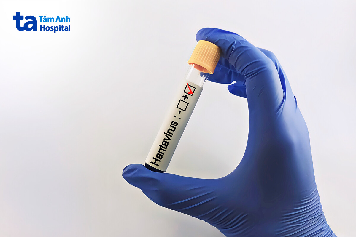 Hội chứng phổi do virus Hanta (HPS): Dấu hiệu và hướng điều trị 17 test hantavirus