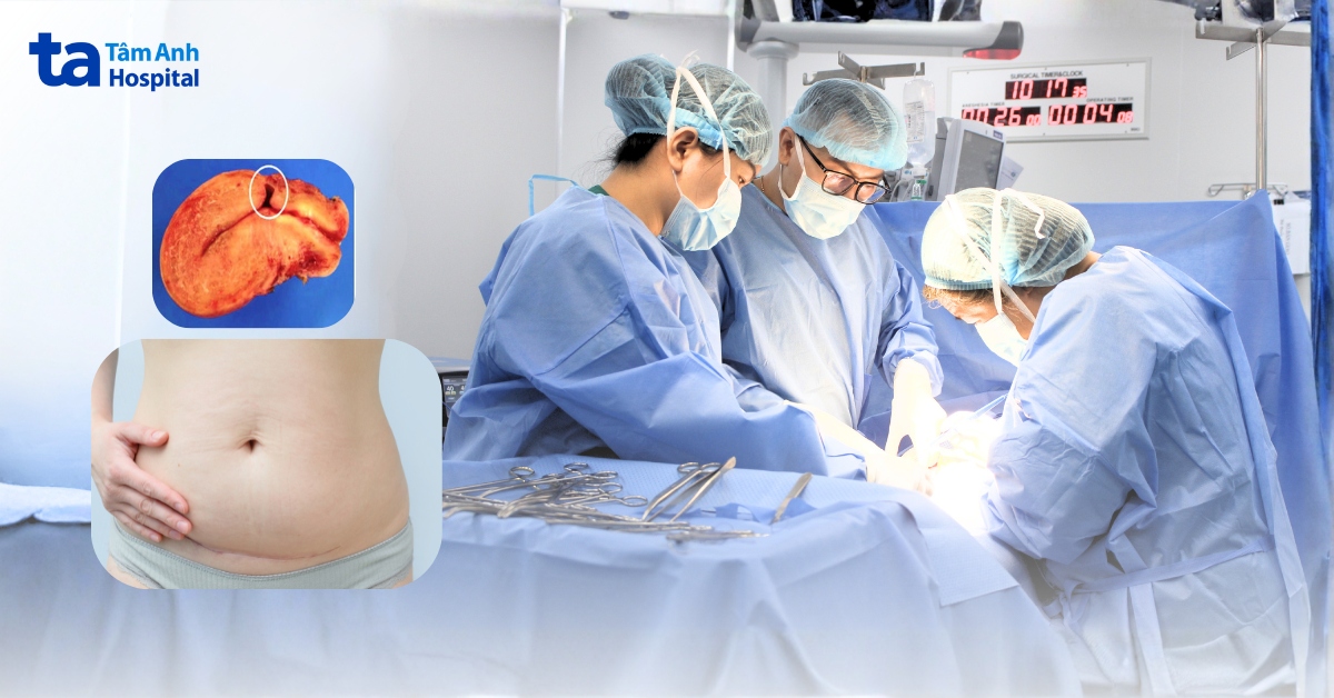 Thai kỳ có vết mổ cũ và những nguy cơ tiềm ẩn cần đặc biệt lưu ý
