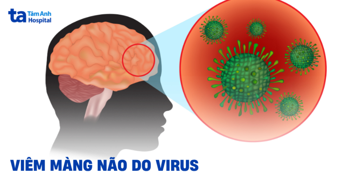 Viêm màng não do virus: Thông tin đầy đủ