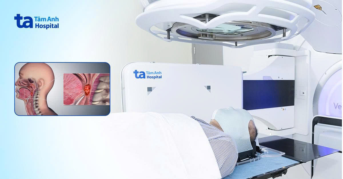 Hóa xạ trị hiệp đồng triệt căn ung thư