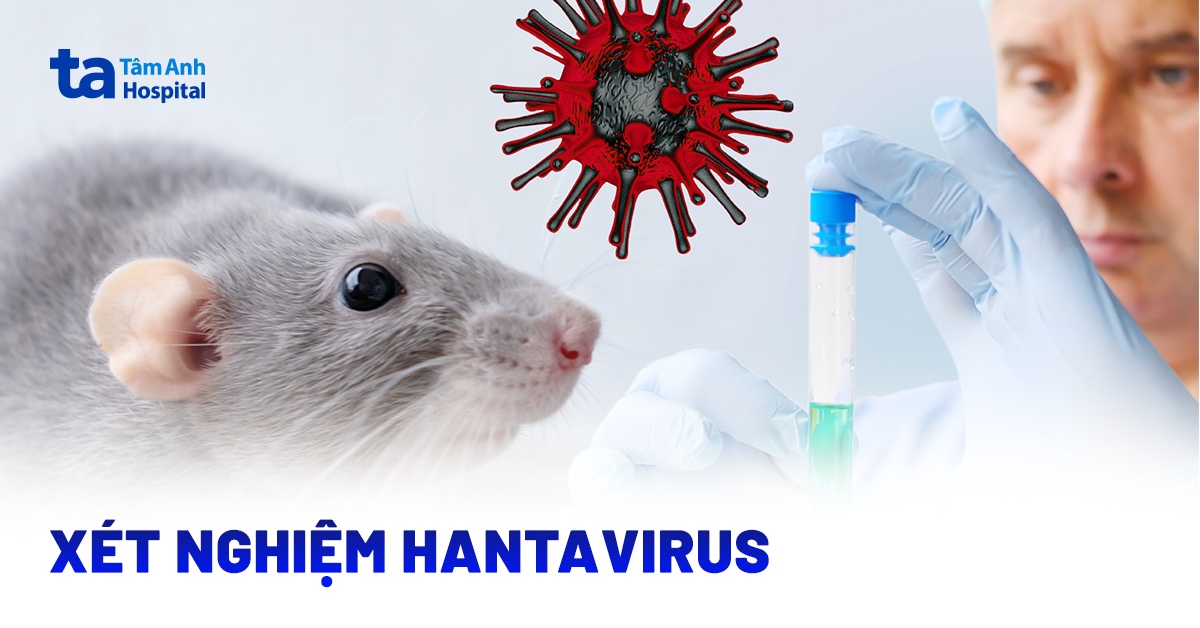 xét nghiệm hantavirus