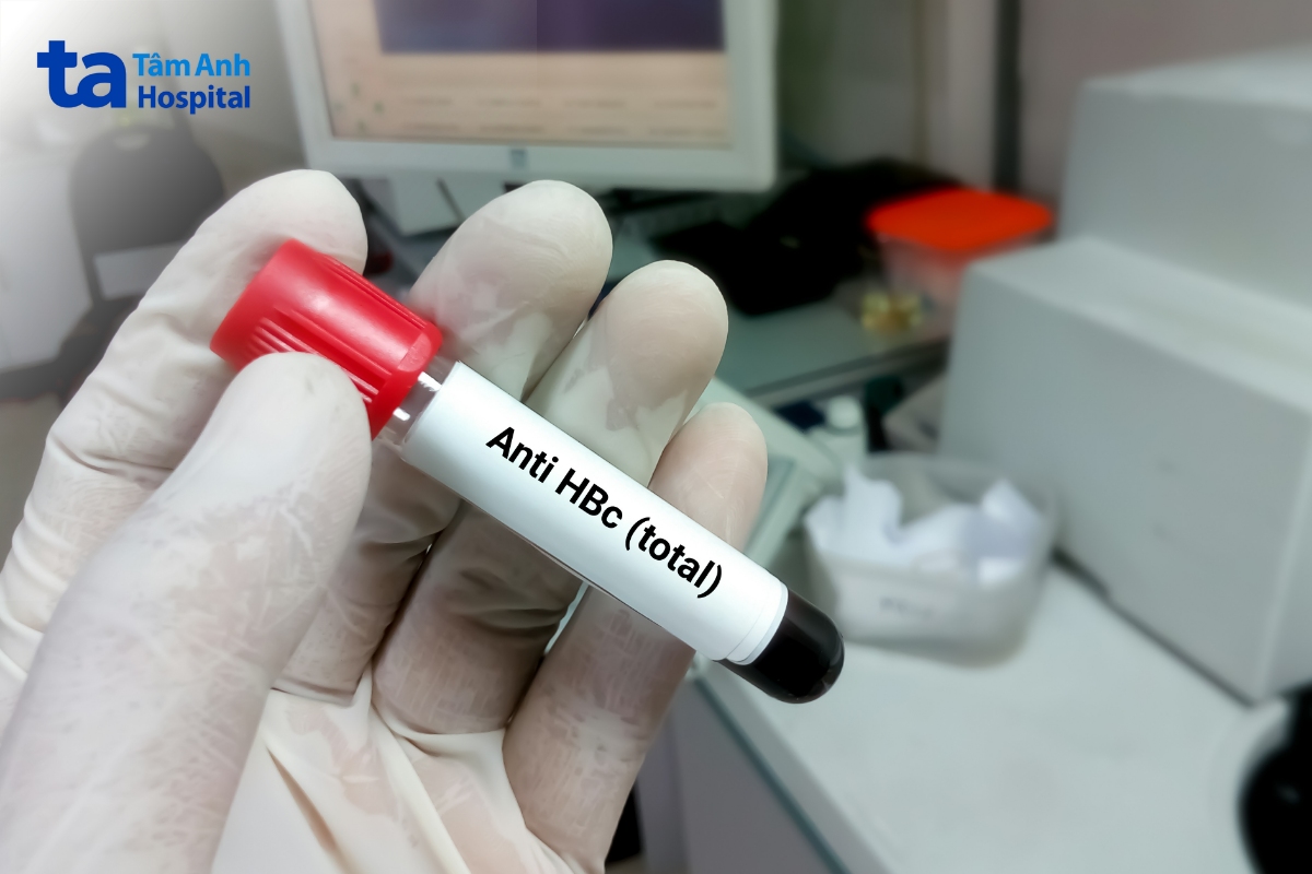 Kháng Thể Viêm Gan B: Vai Trò Trong Miễn Dịch Anti Hbc Test