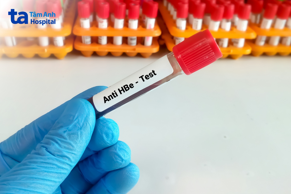 Kháng Thể Viêm Gan B: Vai Trò Trong Miễn Dịch Anti Hbe Test