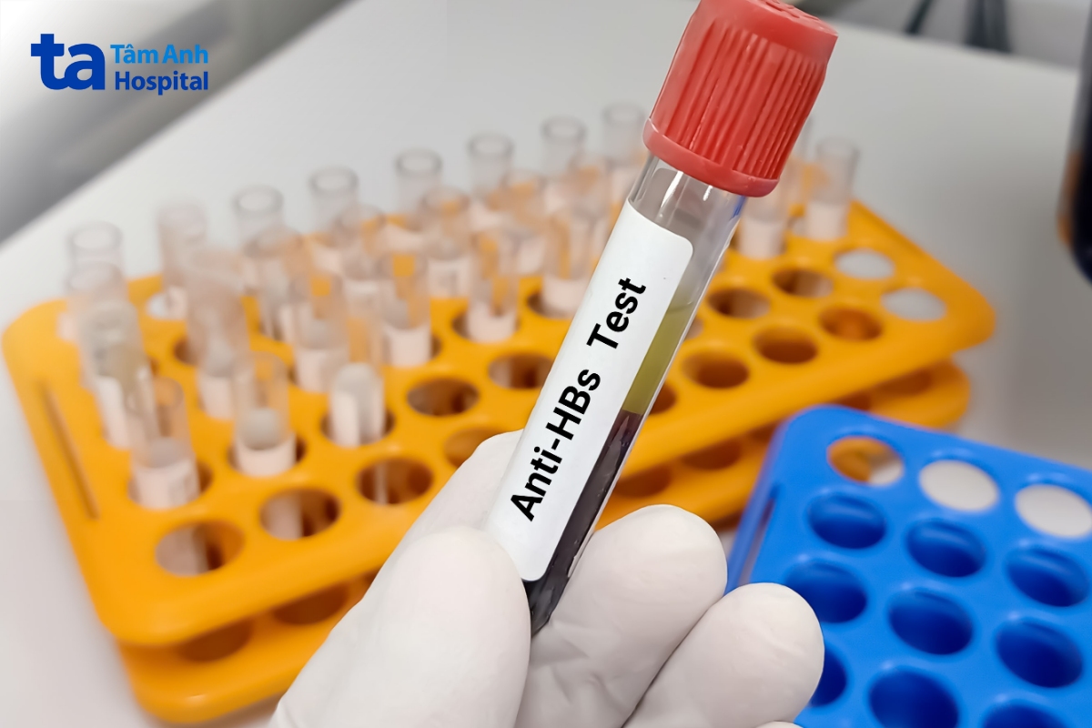Kháng Thể Viêm Gan B: Vai Trò Trong Miễn Dịch Anti-Hbs Test