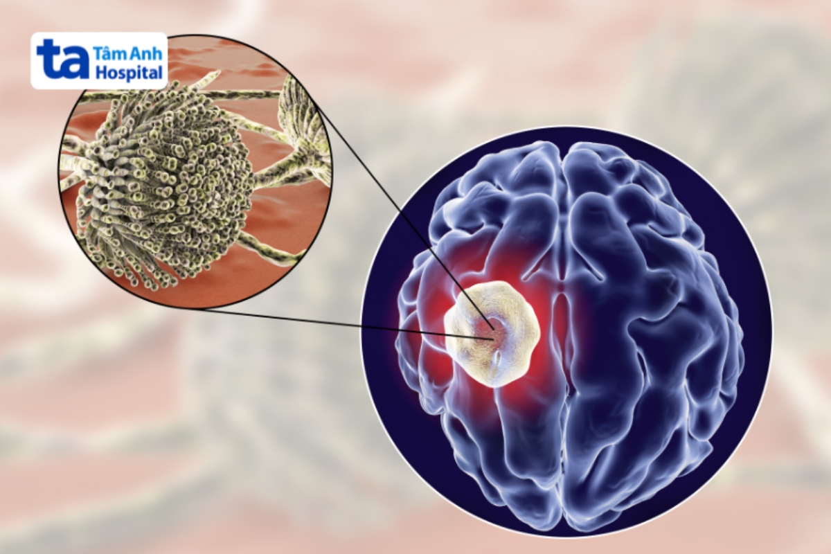 Aspergillus