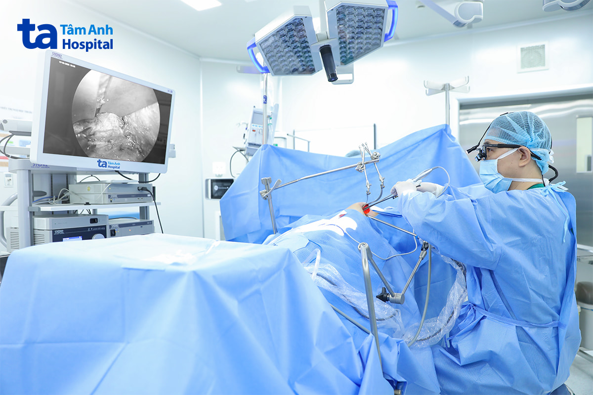 Bác sĩ Dũng cắt nhân giáp cho bệnh nhân bằng phương pháp nội soi ít xâm lấn