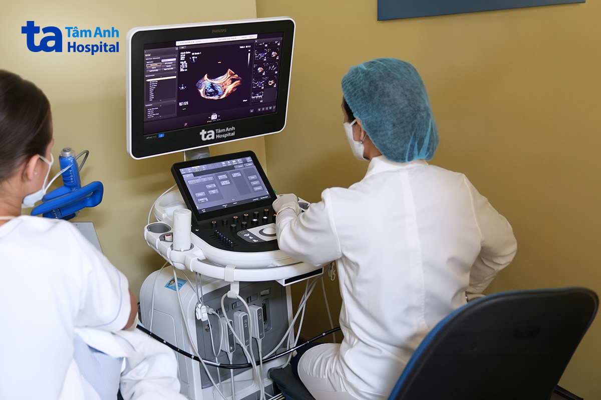 Bác sĩ khoa Tim mạch siêu âm cho người bệnh qua thực quản