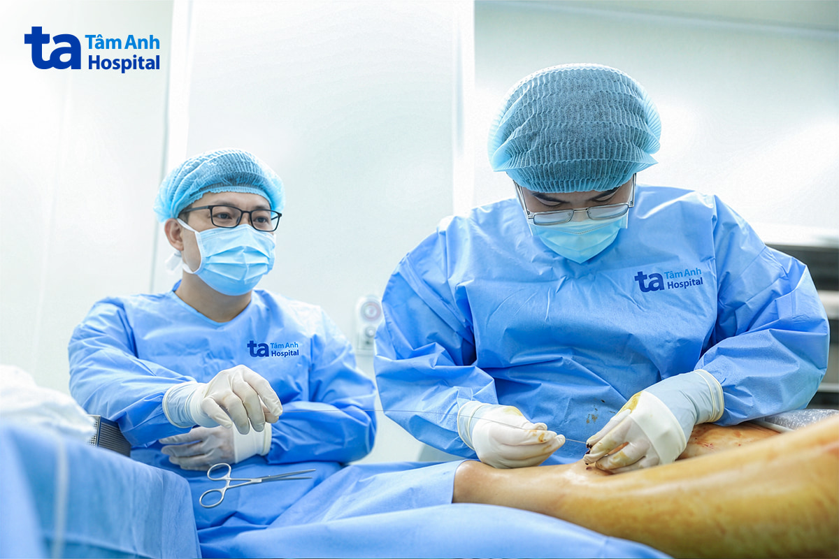 Bác sĩ luồn dây dẫn qua vết rạch da nhỏ để đi đến tĩnh mạch bị suy