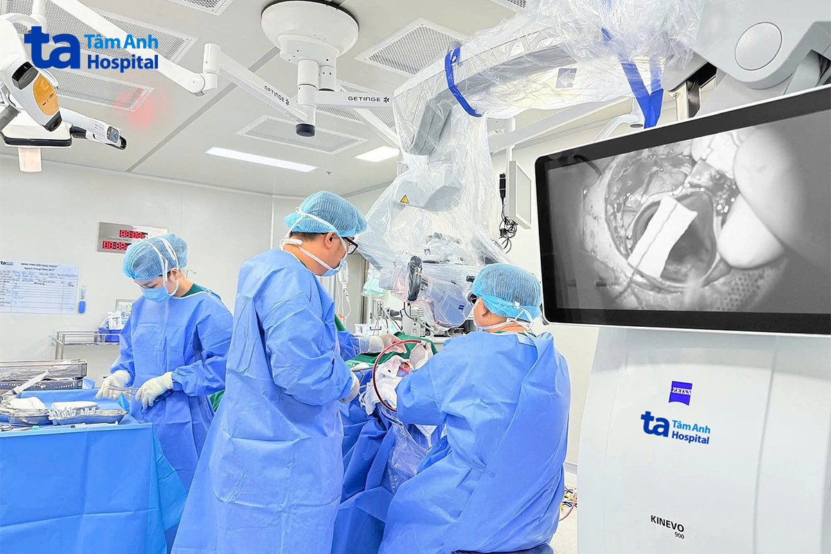 Bác sĩ phẫu thuật lấy khối máu tụ bằng kính vi phẫu AI K.Zeiss Kinevo 900