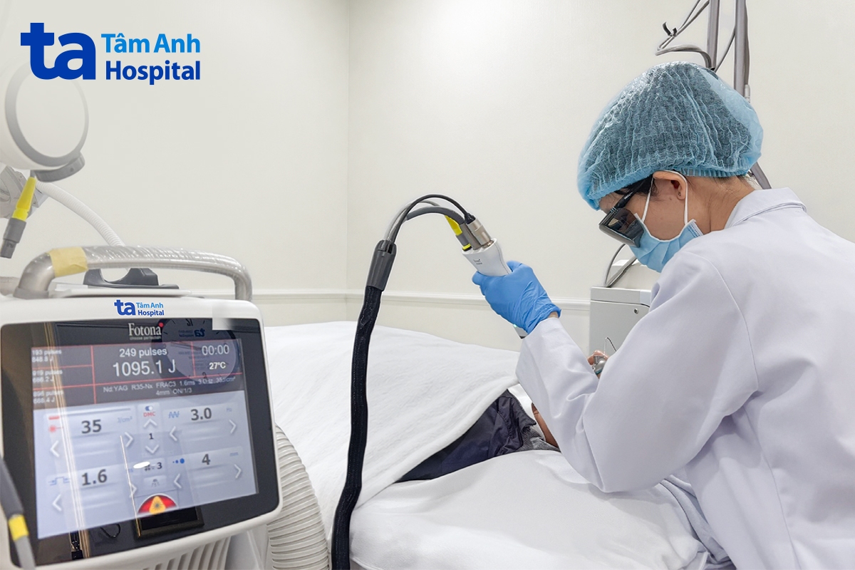 bác sĩ sử dụng laser 6d điều trị tình trạng mụn viêm cho thái