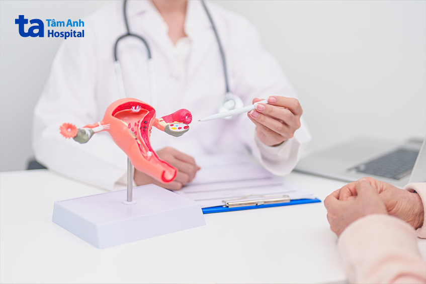 Bác sĩ tư vấn về buồng trứng nữ