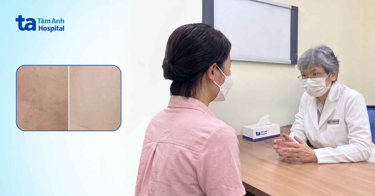 Bé gái 7 tháng tuổi nổi ban đỏ khắp người