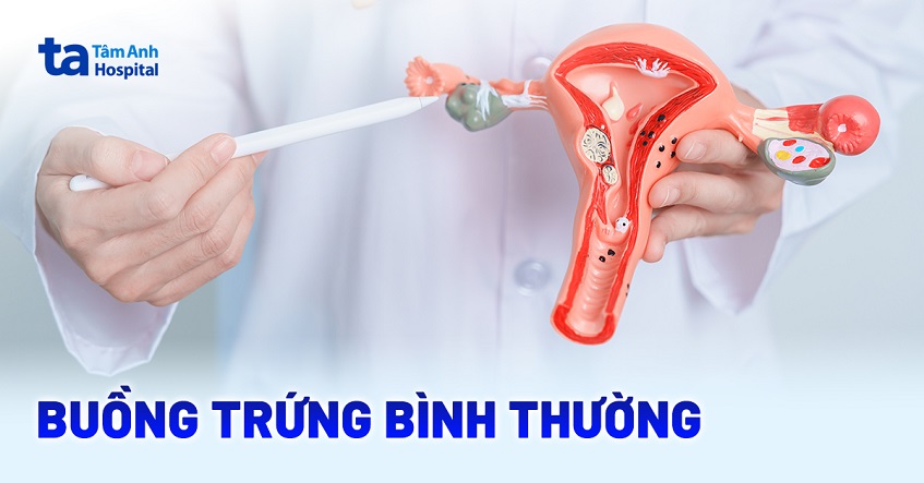 Thế nào là một buồng trứng bình thường và khỏe mạnh?