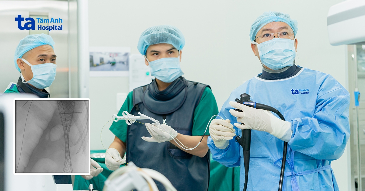 Phát hiện ung thư đại tràng di căn từ dấu hiệu đau lưng
